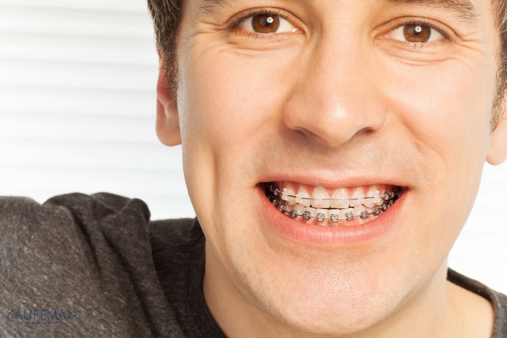 young man with metal braces - overbite vs underbite in New Braunfels, TX 